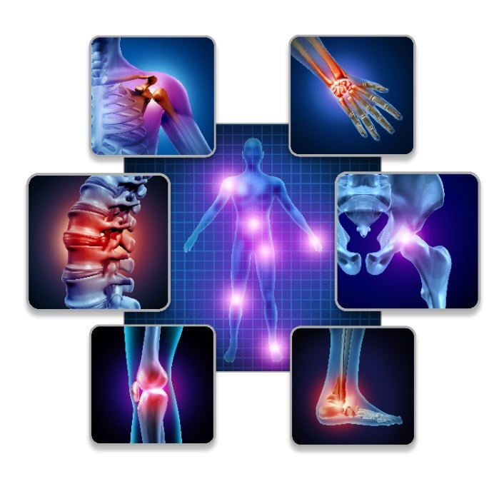 Image of joint pain all over the human body but CBD can help